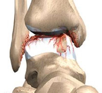 pasted20image20200x183